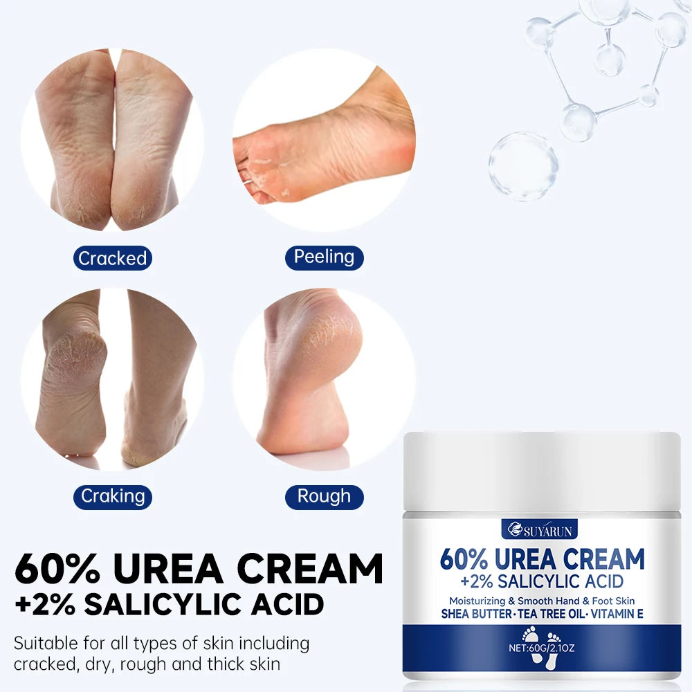 SUYARUN 60% Urea Foot Cream for Cracked Heels & Dry Skin - Intensive Moisturizing Treatment, Callus Remover, Diabetic Foot Care.